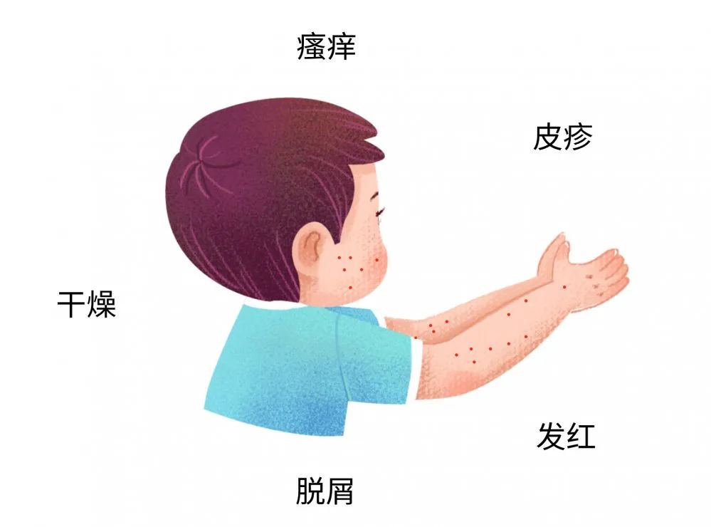 这些症状都可能是宝宝过敏传递的信号，，很多宝妈还不知道
